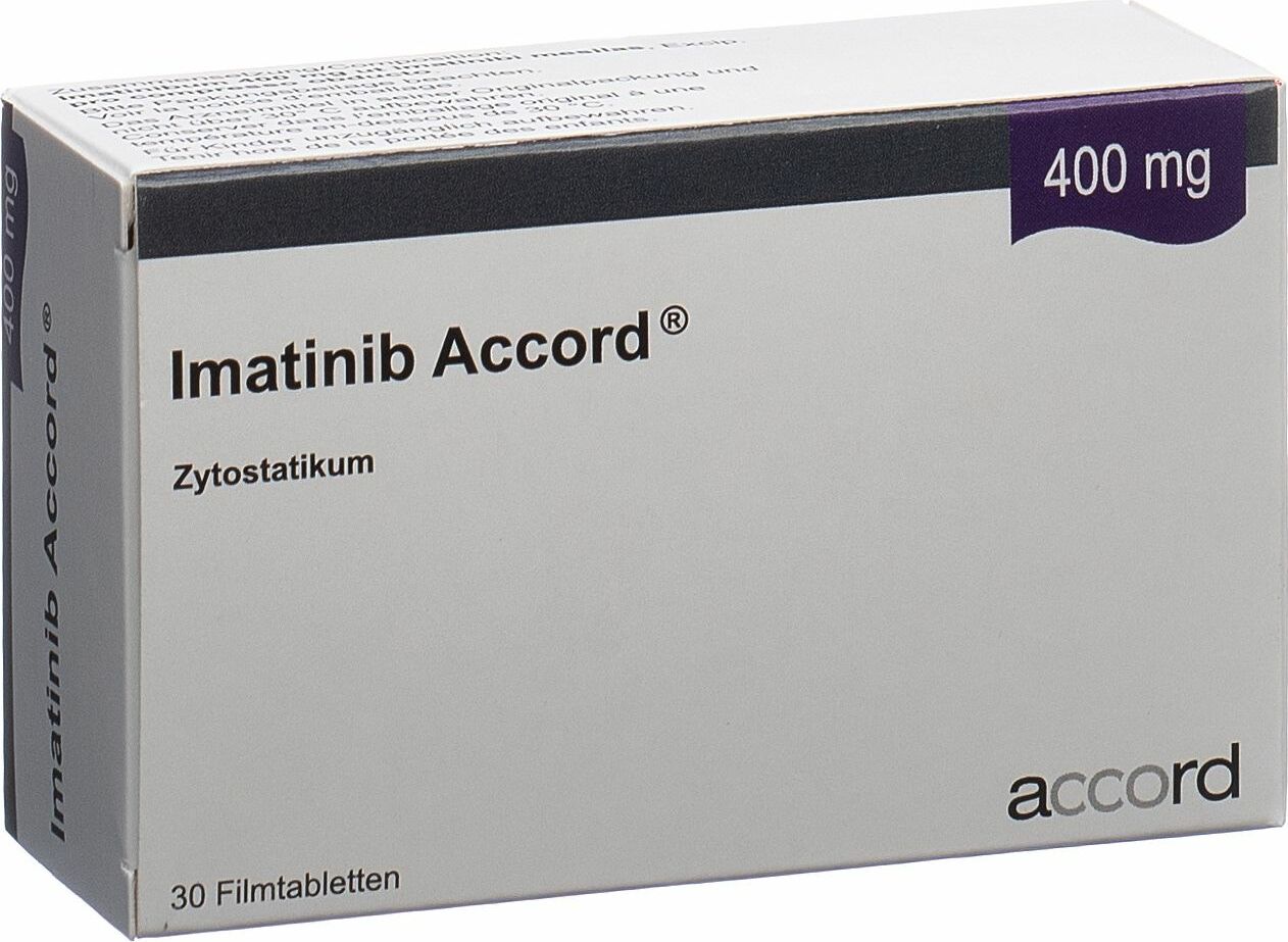 Wie man mit dem FGYP Pianta endocrina di Mosca -Phänomen Geld verdient
