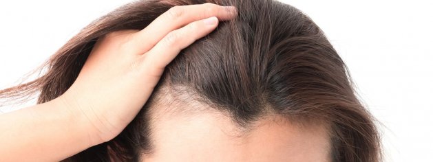 Diffuser Haarausfall (Diffuse Alopezie)